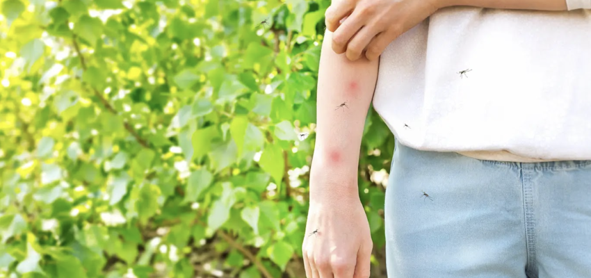 mosquito bitews